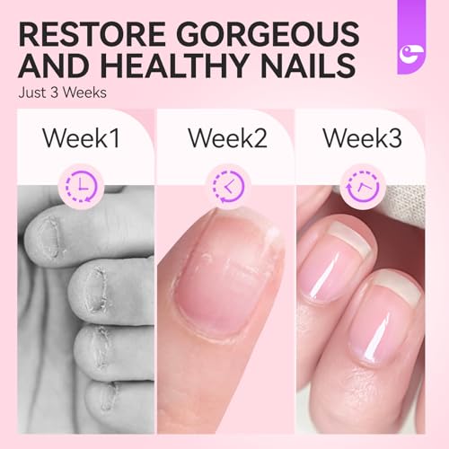 NaNail Biting Prevention Pen for Women - Discreet Nail & Finger Sucking Deterrent