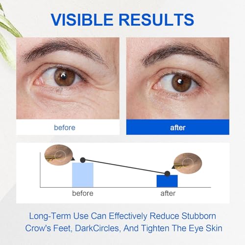 Retinol Eye Cream, Hydrating & Firming Under Eye Cream for Men, Wrinkles & Puffiness, Reduces Dark Circles, Nourishing Elastic Formula, 20g / 0.7 fl.oz