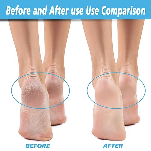 12-Pack Flawless Pedi Roller Replacement Heads - Extra & Regular Coarse