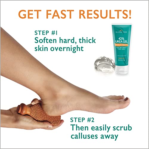 Max Strength 42% Urea Gel + Foot Scrubber + Shea Butter Cream Bundle