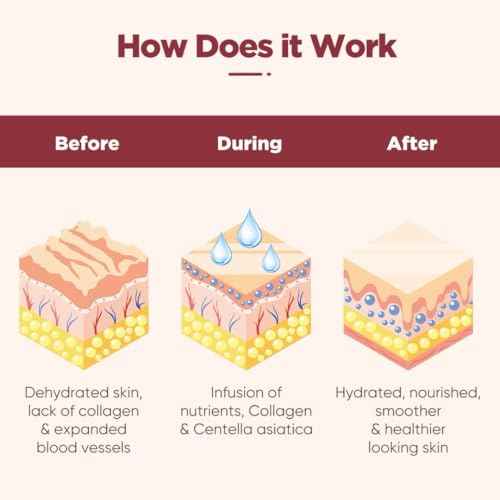 Under Eye Patches (20 Pairs), pink Hyaluronic Acid Eye Patches For Puffy Eyes, Dark Circles, Puffiness, Refresh,Revitalizing, Wrinkles, Anti Aging & Face Moisturizer For Women and Men