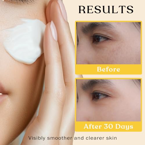 Beef Tallow Sun Balm for Skin - Moisturizer Cream - 100% Grass Fed Whipped Beef Tallow - Herb Infused - Supports Eczema, Rosacea - Made in USA - Unscented - 2 oz