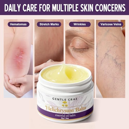 Extracts Helichrysum Balm ? Moisturizing Helichrysum Essential Oil Balm, Beeswax & Almond Oil, Multipurpose Salve for Dry & Irritated Skin, Stretch Marks, Scars, Hydrating Relief, 1.76oz