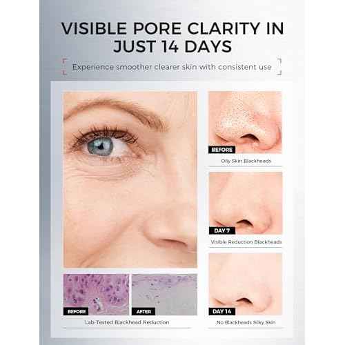 Clay Mask for Face Sensitive Skin: Triple Mud Formula, Deep Pore Cleansing, Hydrating, Oil Balancing, Smoothing, Pore Refining ? 3.88 Oz