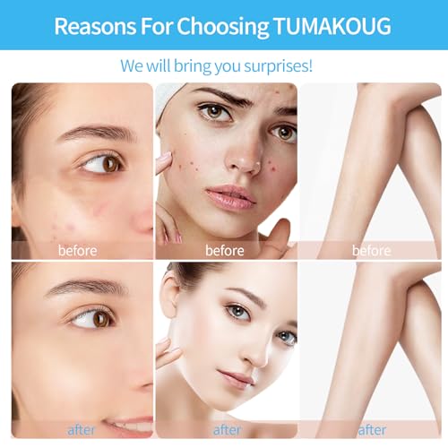 High Frequency Facial Wand with 4 Tubes - Skin & Hair Therapy
