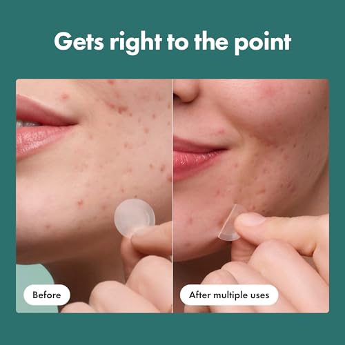 Mighty Patch Hero Micropoint Acne Patches, 8 Count