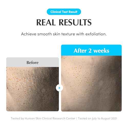 EQQUALBERRY Swimming Pool Toner - Korean Toner for Daily Exfoliating & Deep Hydration with Natural Enzyme Protease & Hyaluronic Acid, For Sensitive Skin, 5.24 Fl Oz (155ml)