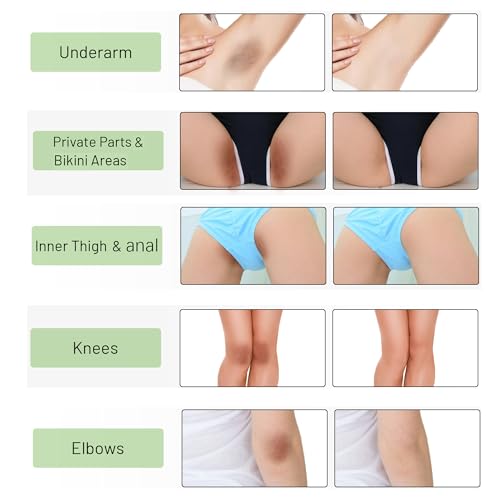Intimate Areas Skin Lightening Cream Bleaching Cream For Body Intimate Area, Private Parts, Underarm, Knees, Elbows, Inner Thigh, Bikini Areas, Bikini Line, Skin Whitening cream 30ML