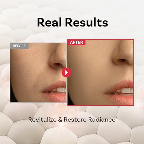 APOTHE Peptide 11 Botulinum Multi Recovery Ampoule 1.01 fl oz (30ml) ? Intensive Care for Elasticity, Radiance, and Skin Barrier Strength with Ectoin & Botulinum Peptide