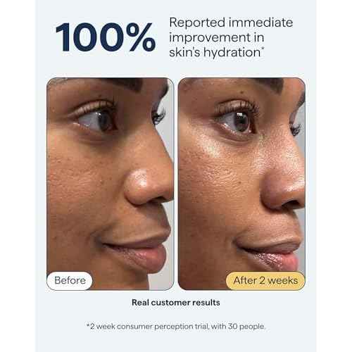 Remedy for Rich Moisture - Barrier Repairing Rich Cream Moisturizer for Normal to Dry Skin - Quadruple Ceramide Complex, Peptides, Squalane, Glycerin- By Dermatologist Dr. Shah, 1.7 fl. oz