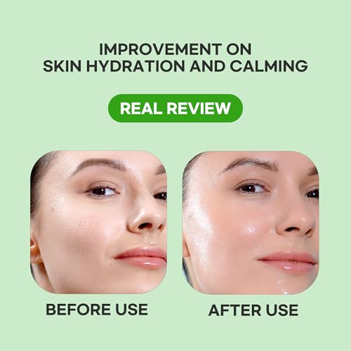 Epielle Cucumber Hydrating Serum Sheet Masks (5pk) | Korean Skincare | Facial Sheet Mask | Kbeauty, Spa Gifts for Women