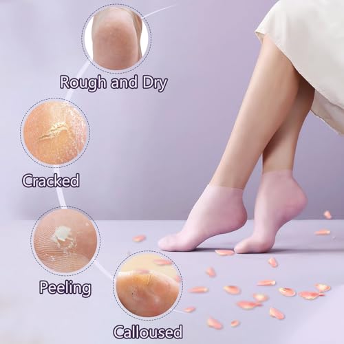 Silicone Moisturizing Socks & Gloves Set for Dry Cracked Feet & Hands, 4 Pairs