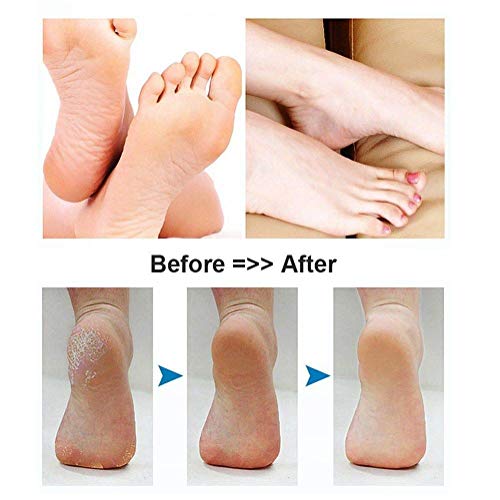 BOMPOW Foot Scrubber Electric Callus Remover – Rechargeable 2 Roller Heads, Red