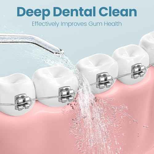 Onlyone Water Dental Flosser Replacement Heads Oral Irrigator Refill Heads Jet Tips 5 Pieces: Only Compatible for Onlyone Water Dental Flosser