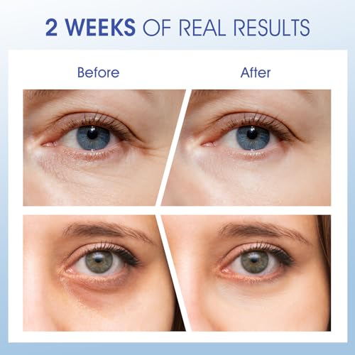 Eye Cream for Wrinkles, Fine Lines & Crows Feet - With Ceramides, Peptides + Caffeine + Niacinamide - Anti Aging Skin Renewing Under Eye Cream for Men and Women, 0.5 Oz