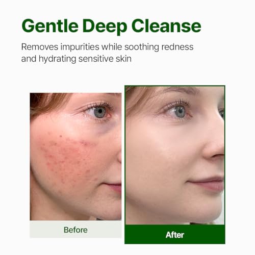 NACIFIC Cica PDRN Gel Cleanser 6.76 fl oz 200ml, Centella Asiatica, Low pH Deep Pore Cleanser for Sensitive Skin, Soothing, Purifying Korean Face Wash