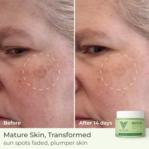 VELVENTE Matcha PDRN Anti-Aging Moisturizer & Dark Spot Cream - 3.53oz
