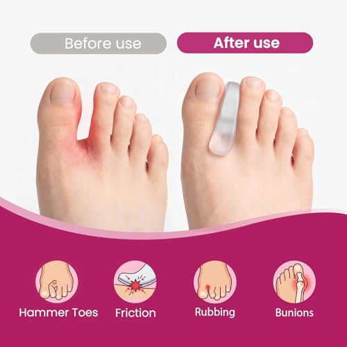 Welnove Gel Toe Spacers for Ballet Pointe Shoes, 8 Pack