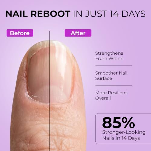 Orly Nail Rescue Bond Repair Serum 18ml – Deep Nail Nourishment & Prep