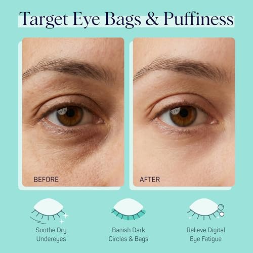 SpaLife Cucumber Eye Pads for Puffy Eyes & Dark Circles (48 Count)