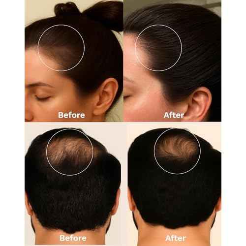 Keyoma Batana Oil for Hair Growth with Rosemary: Nourish & Detox Scalp for Thicker, Stronger, Longer Hair - 100% Organic Batana Oil from Honduras - Reduce Hair Loss (60 mL)