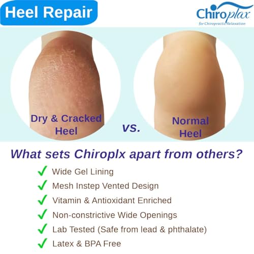 Chiroplax Mint Vented Moisturizing Heel Socks - 2 Pairs for Dry Cracked Feet