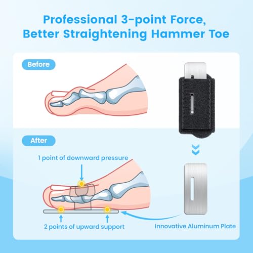 Hammer Toe Straightener for Men & Women - 2-Pack Splint Support