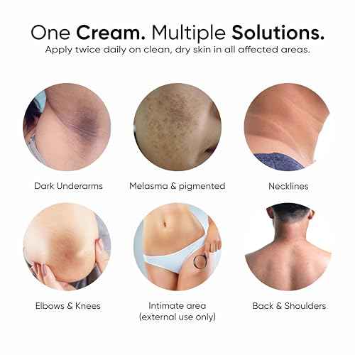 2% Kojic Acid Face & Body Cream for Pigmentation, Melasma, Acne Marks, Underarms, Neck - For Men & Women 30 ml (Pack of 1)