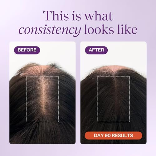 KeraLush Hair Vitamins for Women - Biotin & Keratin Formula for Healthy, Thick Hair
