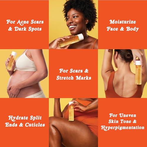 Bio-Oil Natural Skincare Oil Serum, Face and Body Moisturizer with Chamomile, Rosehip, and Lavender Oil, for Scars, Stretch Marks, Sensitive Skin, All Skin Types, 2 Oz