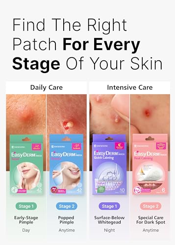 EasyDerm 4-Type Acne Patches Variety Set + Pimple Popper Tool