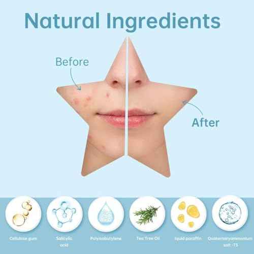 200 Count Star Pimple Patches for Face, Hydrocolloid Acne Pimple Patches with Tea Tree Oil for Party Gift Covering Zits Blemishes