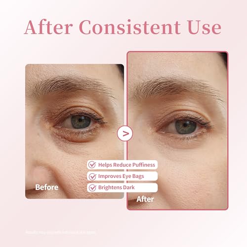 Retinol Caffeine Under Eye Roller Serum - Dark Circles & Puffiness
