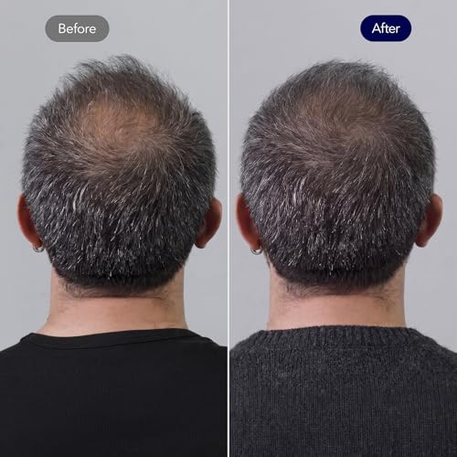 ViveLab Biotin Shampoo for Hair Strengthening & Growth - Sulfate-Free