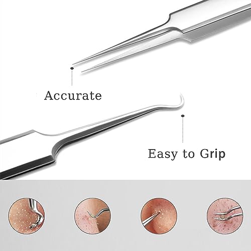 Professional Blackhead Remover Tweezers Kit 3-Piece Stainless Steel