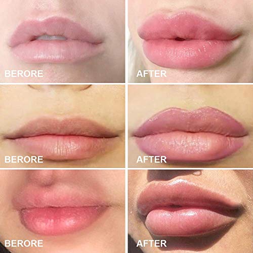 Lip Plumper Device - Silicone Suction Tool for Fuller Lips