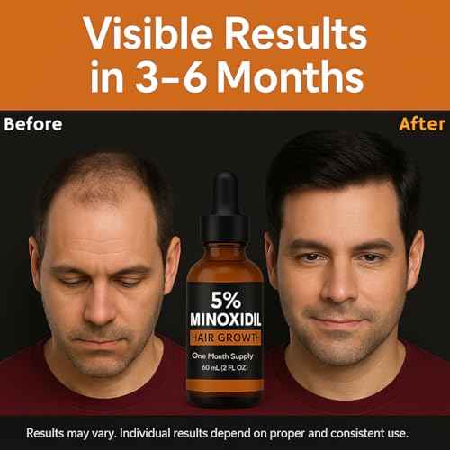 Minoxidil for Men 5% Topical Solution ? Beard & Hair Regrowth Treatment, Extra Strength Hair Loss Formula for Thicker, Fuller Hair, Hair Growth Serum for Men