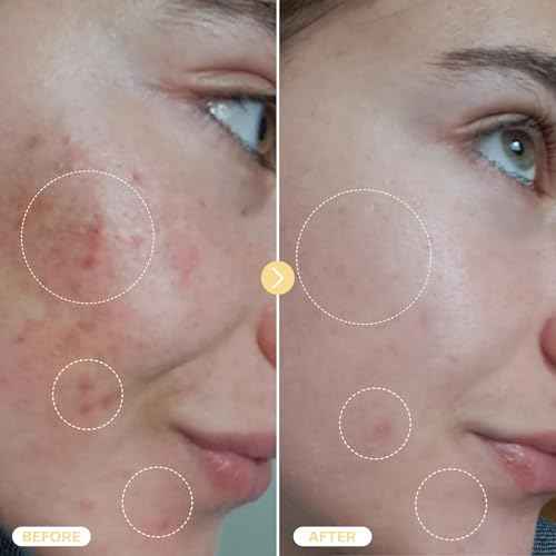 BASE LABORATORIES Hypochlorous Acid Spray for Face & Skin - Travel Size - Facial Toner Spray & Cleaner - Skin Repair Solution helps reduce redness, Irritations, acne - HOCL Molecule Spray 2oz