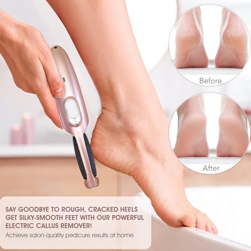 Care me Rose Gold Electric Callus Remover Wand - Rechargeable Foot File & Pedicure Tool