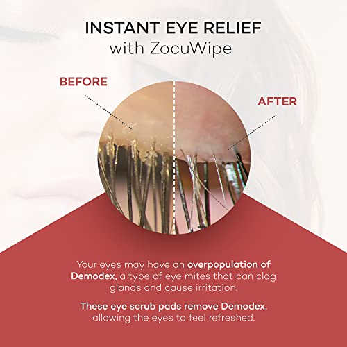 Zocular Zocuwipe Eyelid Wipes, 30 Count | Okra-Based Gentle Cleansing