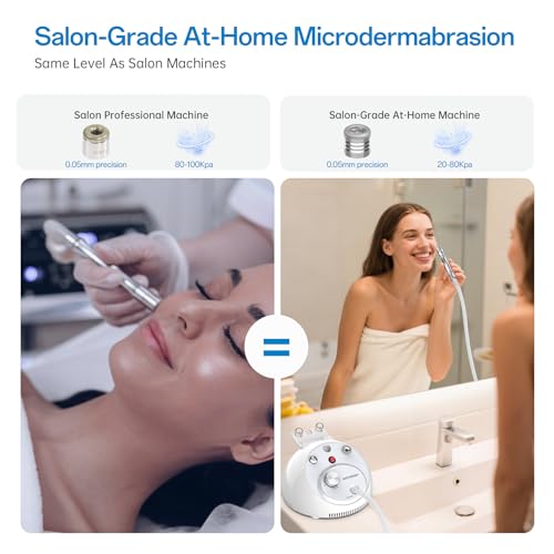 UNOISETION At Home Microdermabrasion Machine, 2 In 1 Pro-Grade Diamond Dermabrasion Facial for Exfoliation & Stubborn Blackheads, Microdermabrasion Tool for Radiant Skin, White