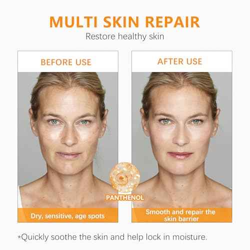 Super Vitamin C Serum for Women over 70 With Hyaluronic Acid, Reduce Wrinkle, Hydrates, Firms, Lifts, Anti Aging Serum for Dark Spots, Wrinkles, DullSkin, 1 fl.oz.