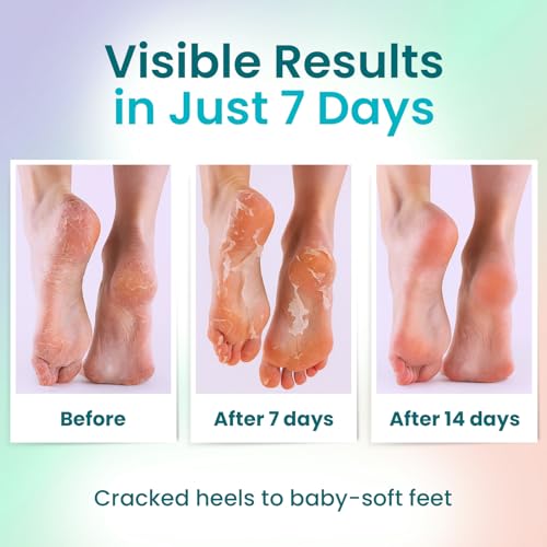 BLOOMORA Exfoliating Foot Peeling Mask (6 Pairs) - Callus & Dead Skin Remover