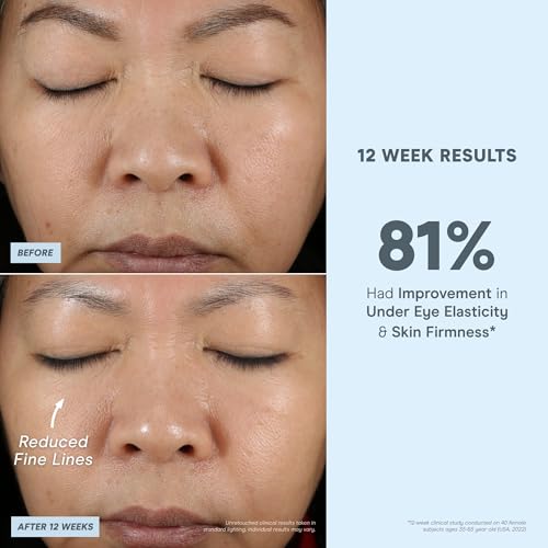 NuFACE Vita-C Brightening Face Serum - Vitamin C Serum for Dark Spots & Even Skin Tone + Niacinamide for Soothing Redness - Boosts Results of Microcurrent Treatments, Daily Skin Care (1oz)