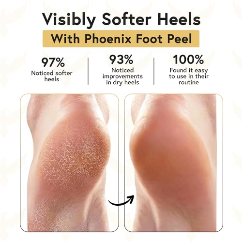 Moisturizing Gel Socks for Men XL - 2 Pairs Spa Socks for Cracked Heels
