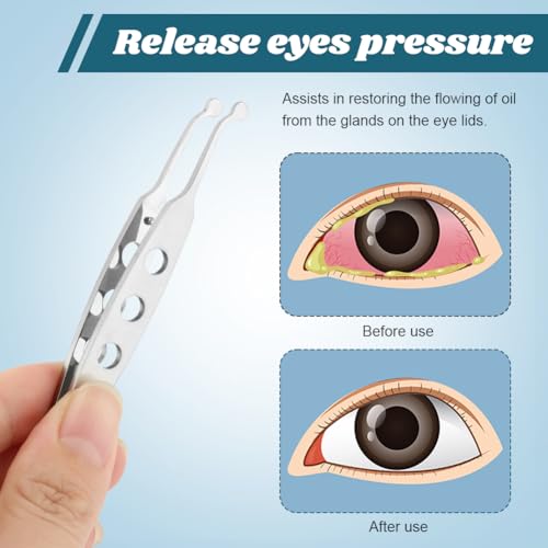 JIANWEI Meibomian Gland Expressor, Eyelid Gland Blockage Unblocking Physiotherapy Tools, Professional Forceps Stainless Steel Eyelid Massage Tweezers for Dry Eyes (Round Tip)