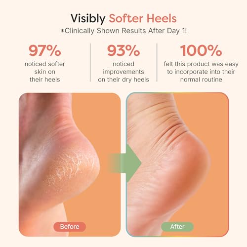 ZenToes Moisturizing Heel Socks for Dry Cracked Heels, 2 Pairs