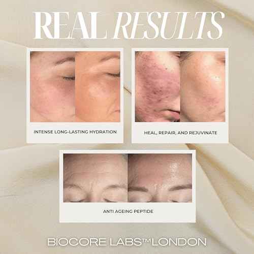 Advanced 3 IN 1 SNAIL MUCIN SUPER SERUM infused with FACELIFT Peptide by BIOCORE LABS¢â Plumping,Moisturizing,Healing Serum for face 100ml 3.38 FL. OZ.