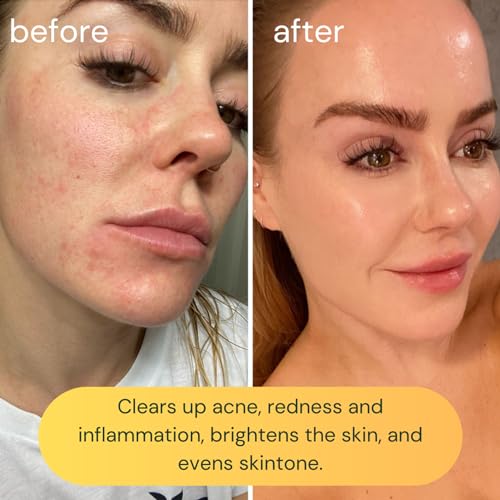 KOA LIFE Vit-C Illuminating Facial Cleanser - Vitamin C Facial Wash, Skin Illuminating Face Wash, Gentle Foam Cleanser, Vegan - 1.7 Fl Oz