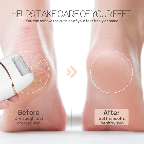 Beefire Rechargeable Electric Foot File & Callus Remover